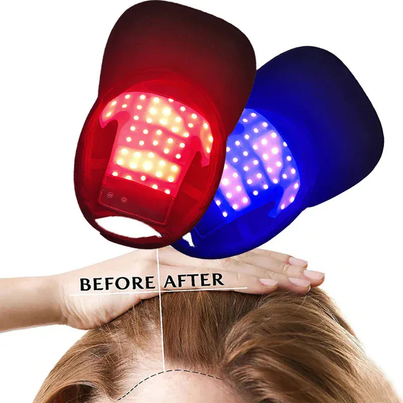 LED Red Light Therapy Cap Hair Growth Helmet Diode LaserHat Light Therapy Cap for Hair Regrowth and Hair Loss Treatment